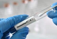 Mehrbelastung durch Testpflicht nicht unter den Tisch kehren