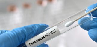 Mehrbelastung durch Testpflicht nicht unter den Tisch kehren