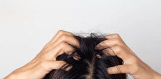 Alles Kopfsache: Haar- und Kopfhautprobleme richtig behandeln