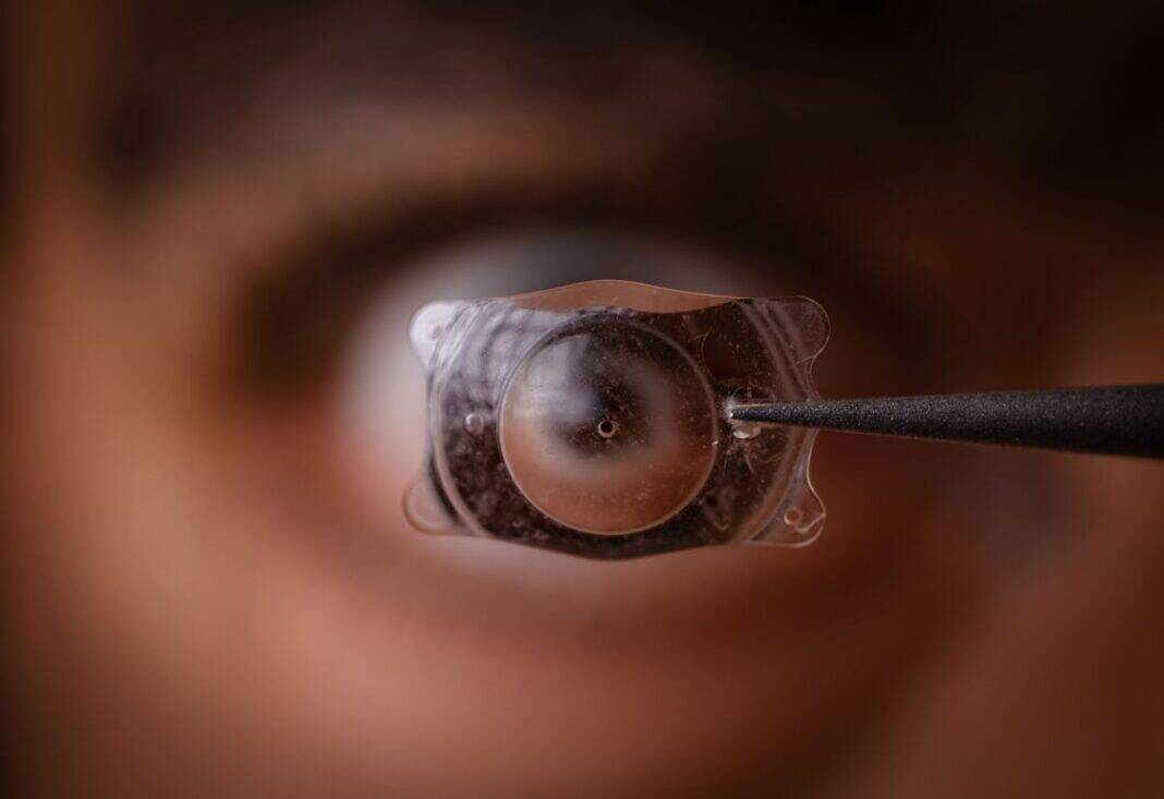 Kontaktlinsen bei Erkältung - riskant für die Augen