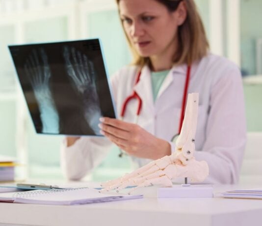 Alarmsignal Osteoporose Alarmsignal Osteoporose