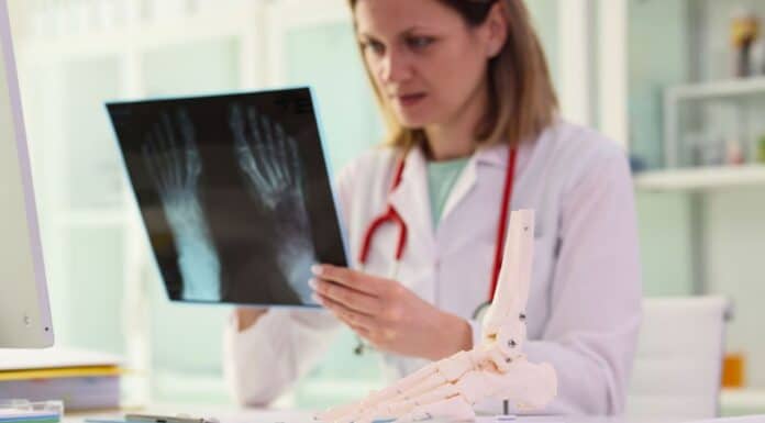 Alarmsignal Osteoporose Alarmsignal Osteoporose